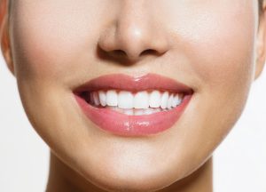 How A Dental Bridge Can Help Maintain Your Smile